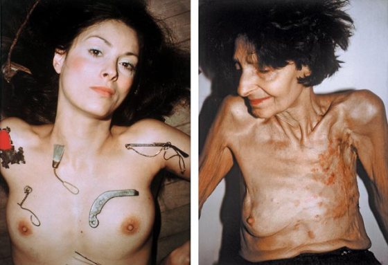 Hannah Wilke before & after