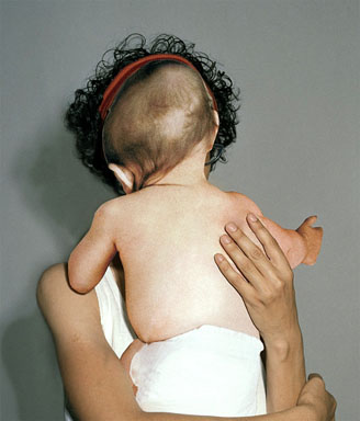 Diana Scherer fragment