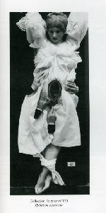 Spitzner c&eacute;sarienne