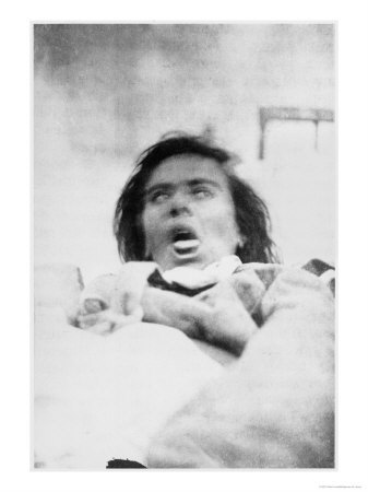 Albert Londe - Hysterical-Epilepsy-Hallucinations-from-Iconographie-De-La-Salpetriere-Giclee