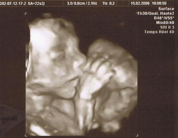 Cassius écho 3D février08