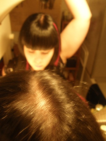 vision de la dure m&egrave;re 16 d&eacute;c 2008